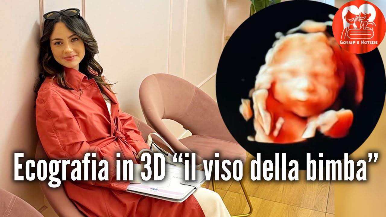 Rosalinda Cannavò vede la sua bimba  dall’ecografia in 3D